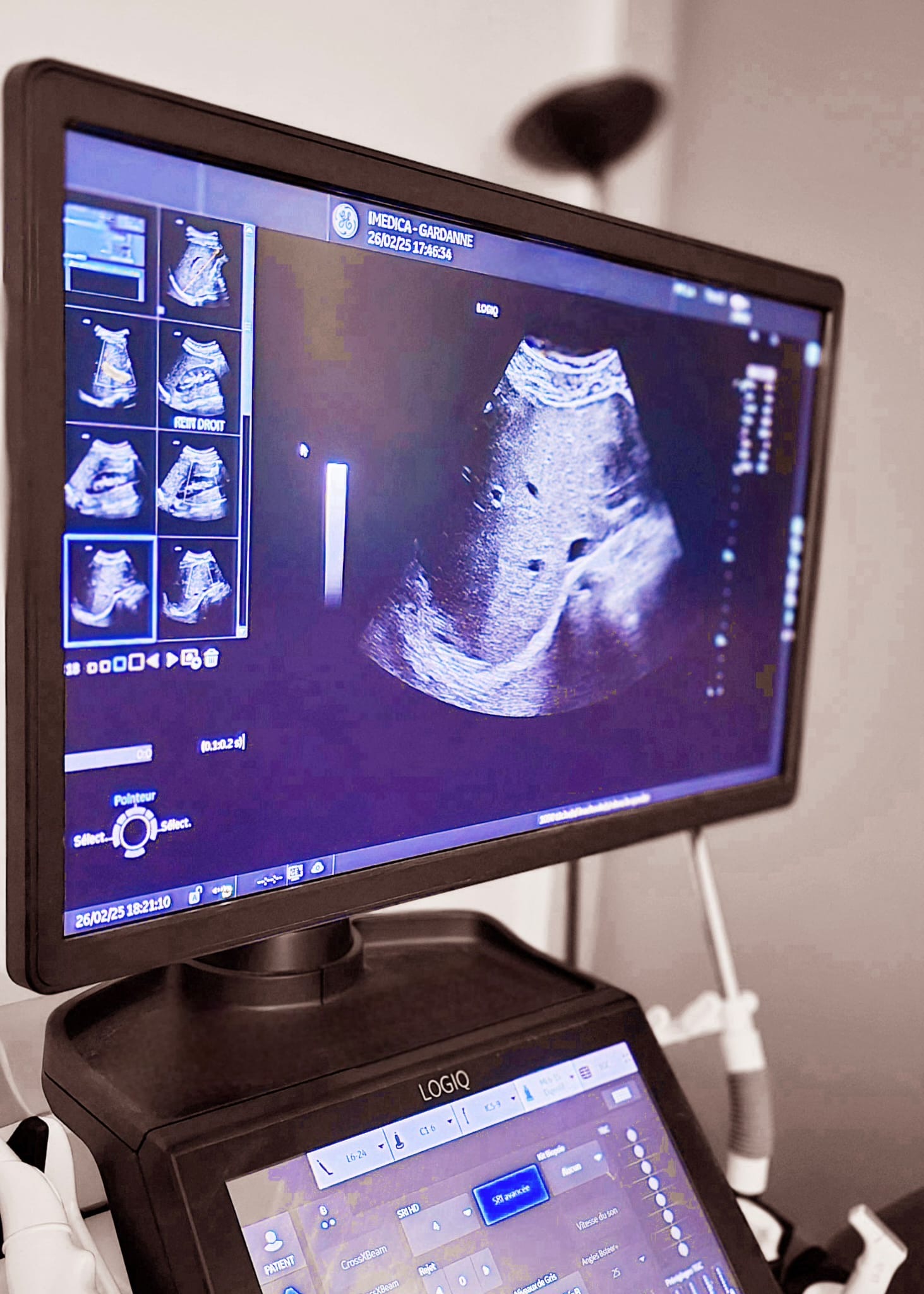 Radio lu par un medecin